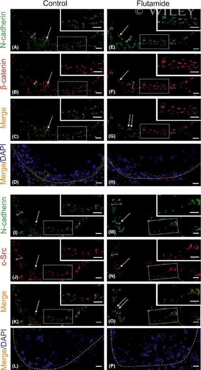 beta Catenin Antibody in Immunohistochemistry (Paraffin) (IHC (P))