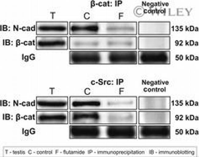 beta Catenin Antibody in Western Blot (WB)