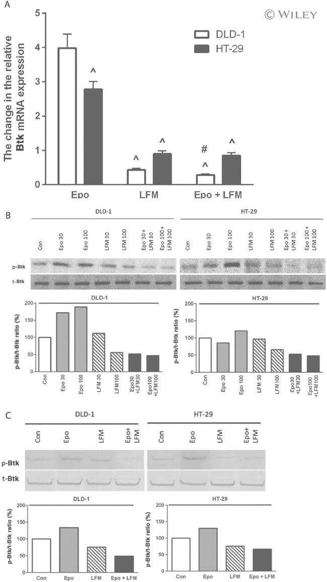 Phospho-Btk (Tyr551) Antibody in Western Blot (WB)