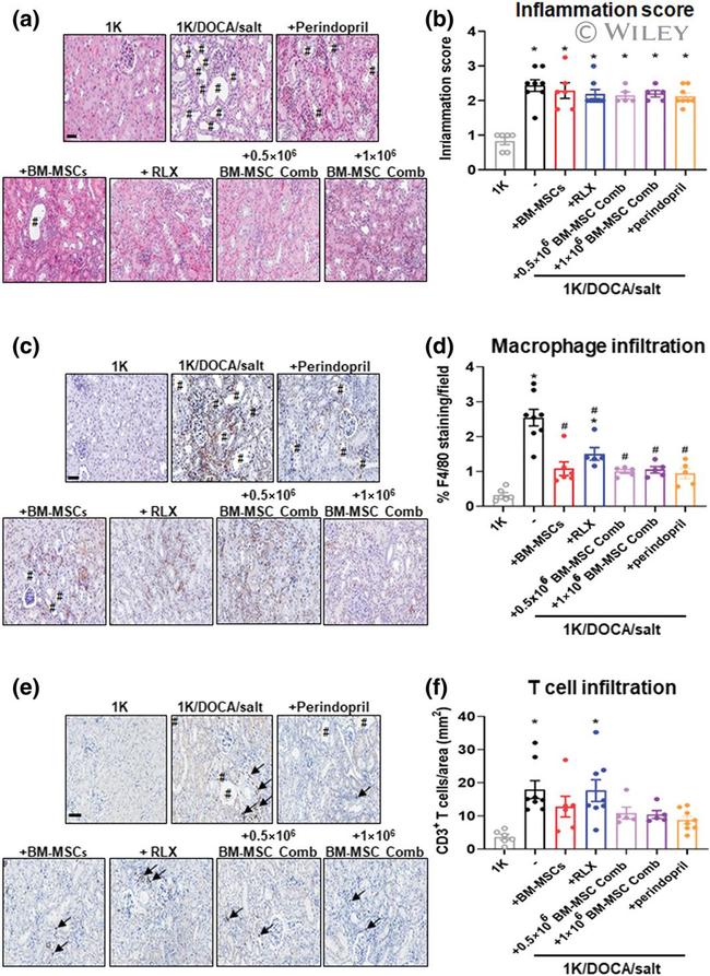 F4/80 Antibody in Immunohistochemistry (IHC)