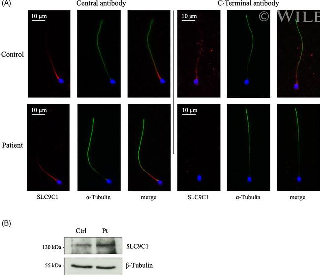 SLC9A10 Antibody in Western Blot (WB)