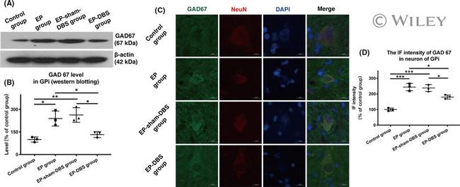 GAD67 Antibody in Western Blot (WB)