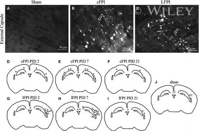 beta Amyloid Antibody in Immunohistochemistry (IHC)