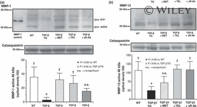 Calsequestrin Antibody in Western Blot (WB)