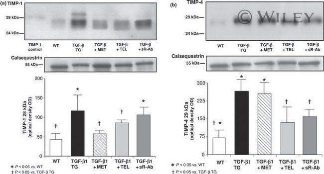 Calsequestrin Antibody in Western Blot (WB)