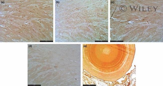 Caveolin 1 Antibody in Immunohistochemistry (IHC)