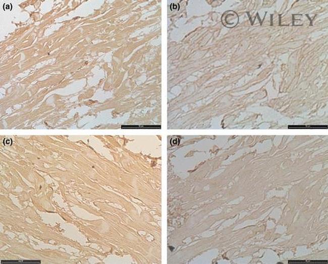 Caveolin 1 Antibody in Immunohistochemistry (IHC)