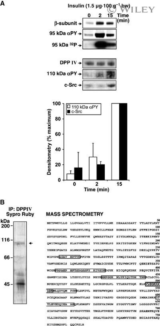 CD26 Antibody in Immunoprecipitation (IP)