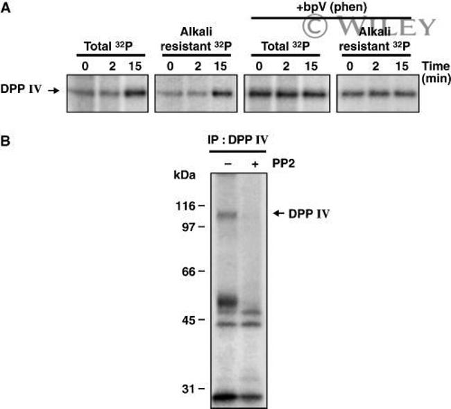 CD26 Antibody in Immunoprecipitation (IP)