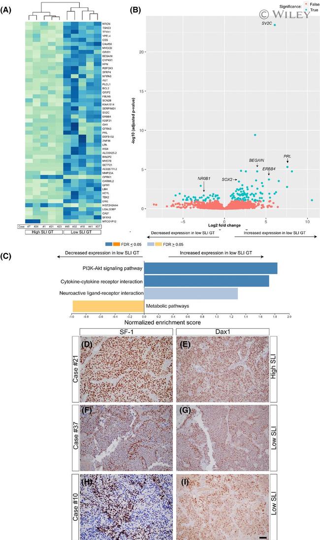 NR5A1 Antibody in Immunohistochemistry (IHC)