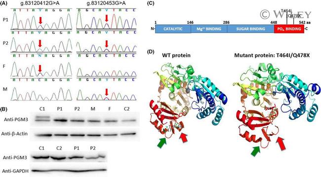 PGM3 Antibody in Western Blot (WB)