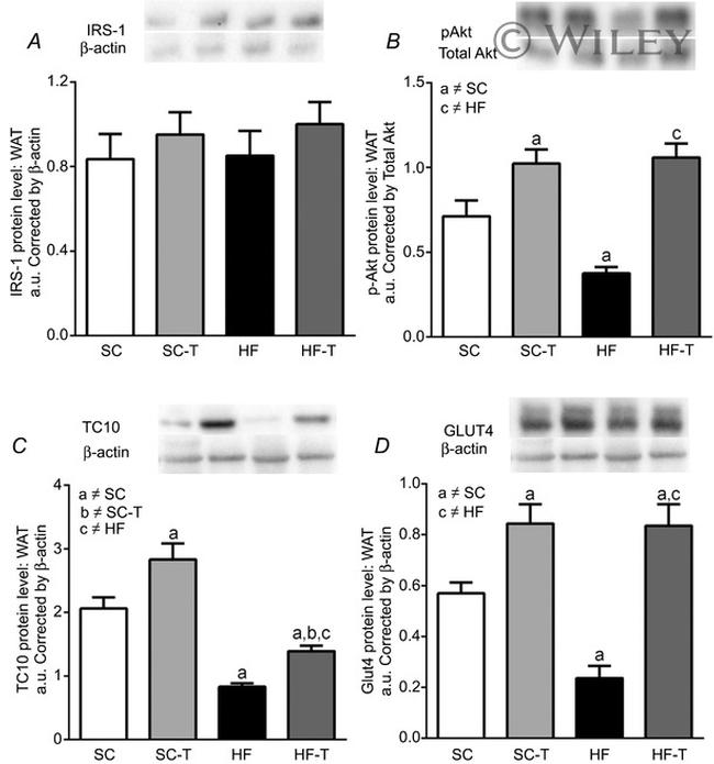 AKT Pan Antibody in Western Blot (WB)