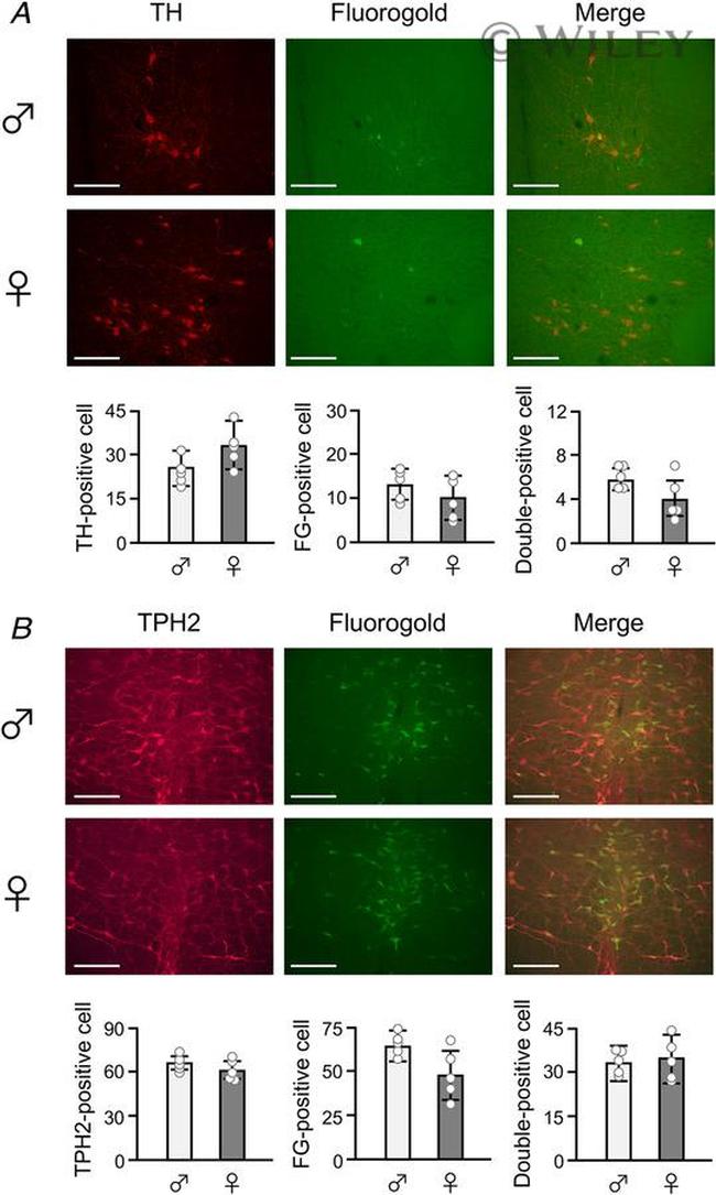 TPH2 Antibody in Immunohistochemistry (IHC)