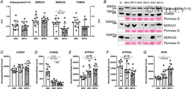 SERCA2 ATPase Antibody in Western Blot (WB)