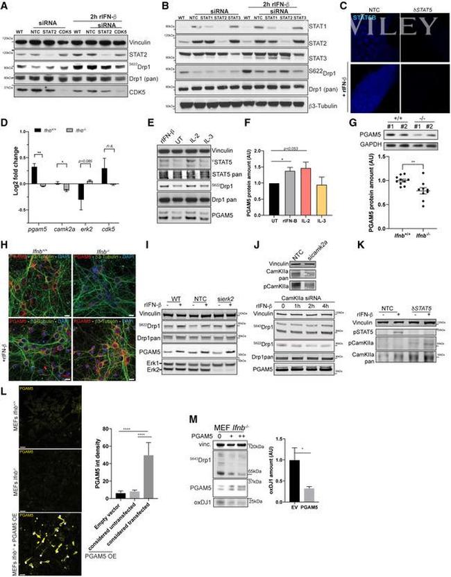 STAT5 beta Antibody in Immunocytochemistry (ICC/IF)