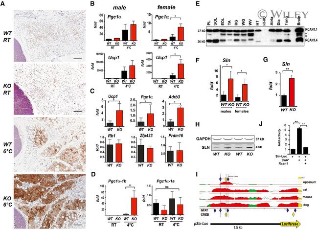 UCP1 Antibody in Immunohistochemistry (IHC)