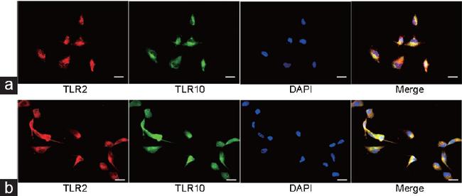 TLR10 Antibody in Immunocytochemistry (ICC/IF)