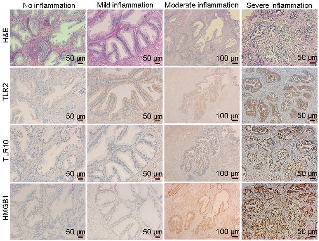 TLR10 Antibody in Immunohistochemistry (IHC)