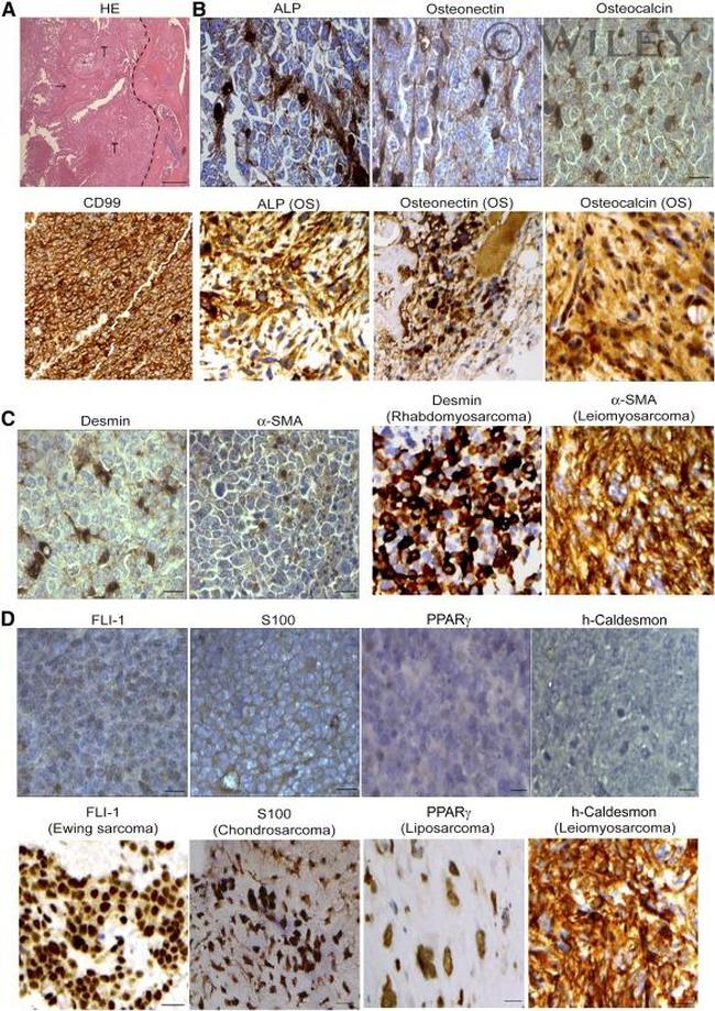 SPARC Antibody in Immunohistochemistry (IHC)