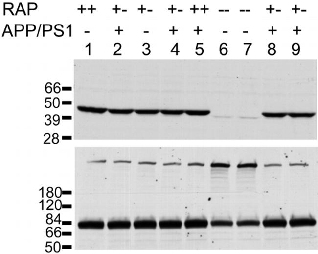 beta Amyloid Antibody in Western Blot (WB)