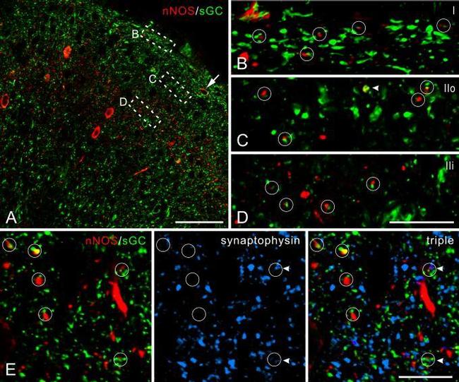 nNOS Antibody in Immunohistochemistry (IHC)