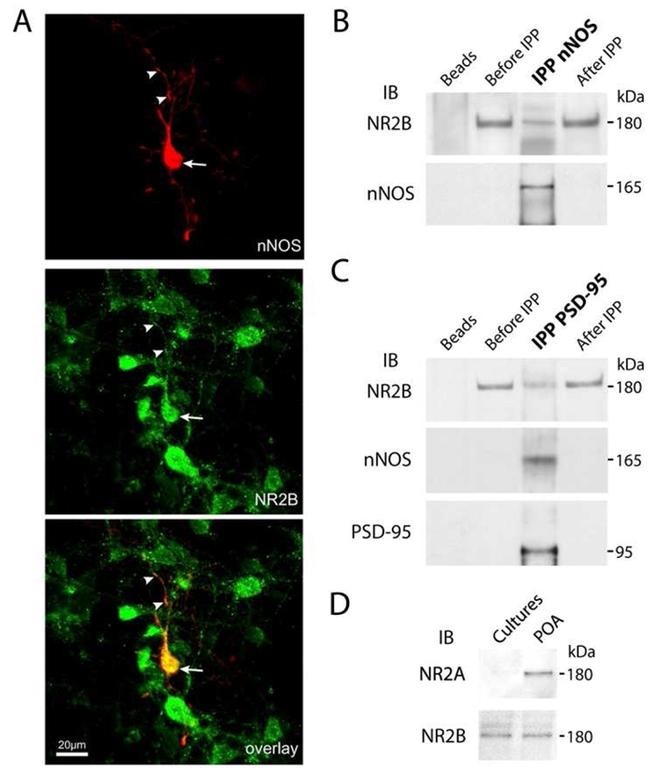 NMDAR2B Antibody in Western Blot, Immunocytochemistry (WB, ICC/IF)