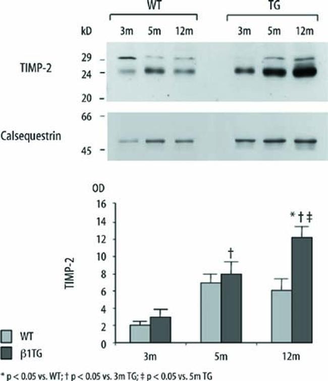 Calsequestrin Antibody in Western Blot (WB)