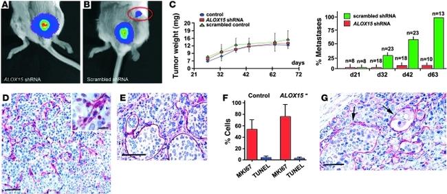 Podoplanin Antibody in Immunohistochemistry (IHC)