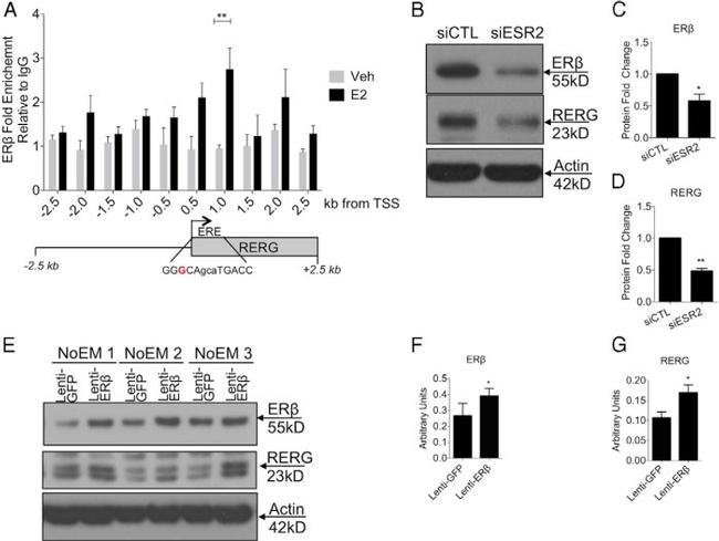 Estrogen Receptor beta Antibody in ChIP Assay (ChIP)