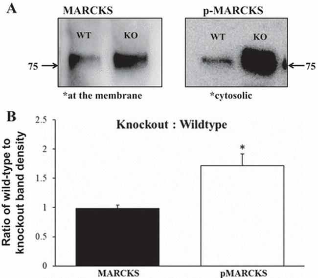 Phospho-MARCKS (Ser152, Ser156) Antibody in Western Blot (WB)