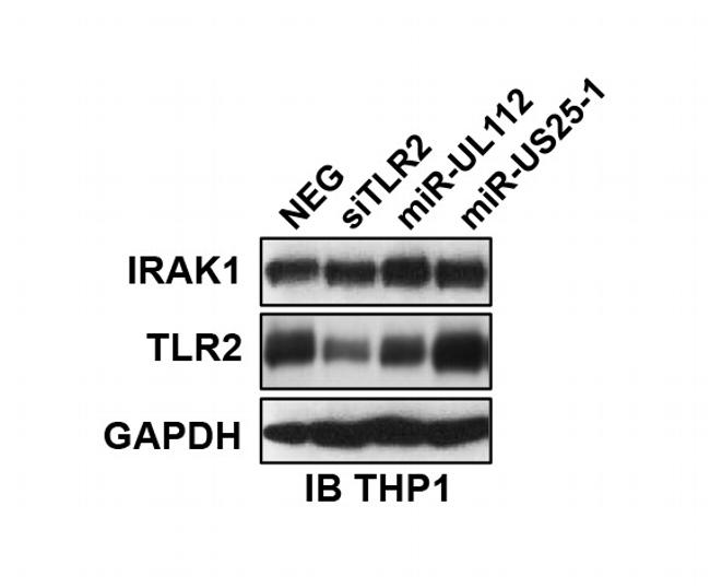 IRAK1 Antibody in Western Blot (WB)