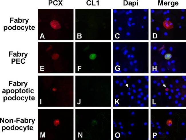 PODXL Antibody in Immunocytochemistry (ICC/IF)