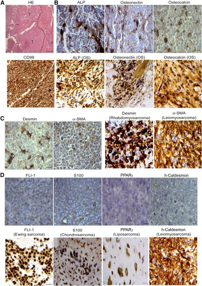 SPARC Antibody in Immunohistochemistry (IHC)