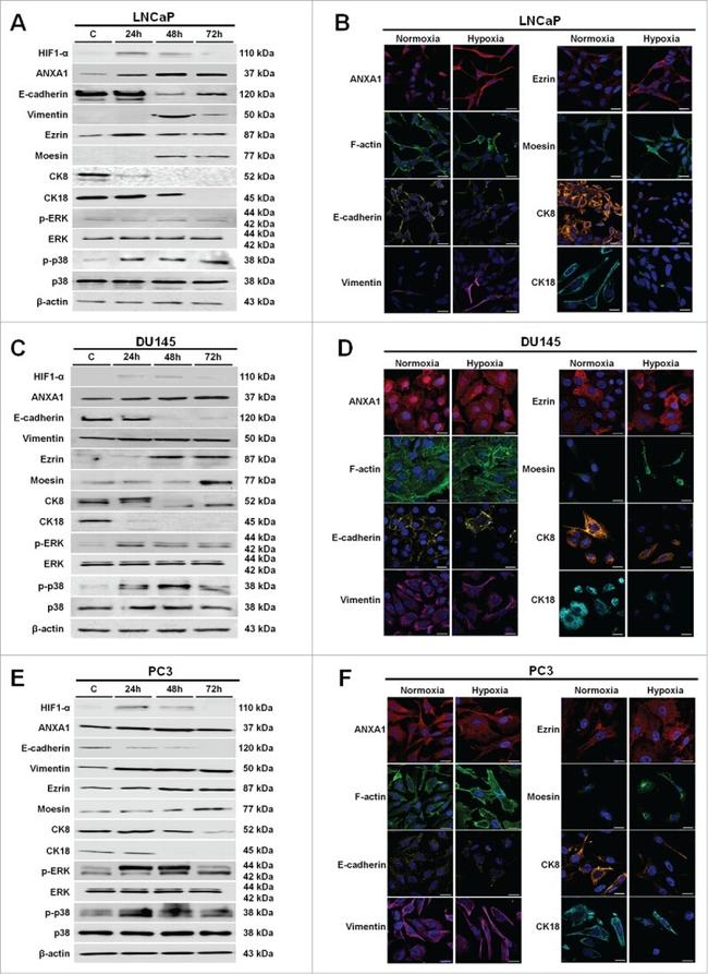 Annexin A1 Antibody in Western Blot, Immunocytochemistry (WB, ICC/IF)