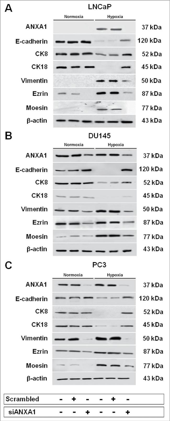 Annexin A1 Antibody in Western Blot (WB)