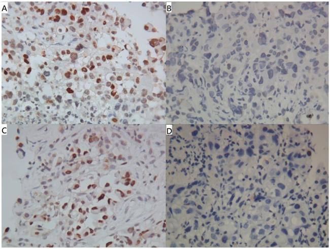 MDM2 Antibody in Immunohistochemistry (IHC)