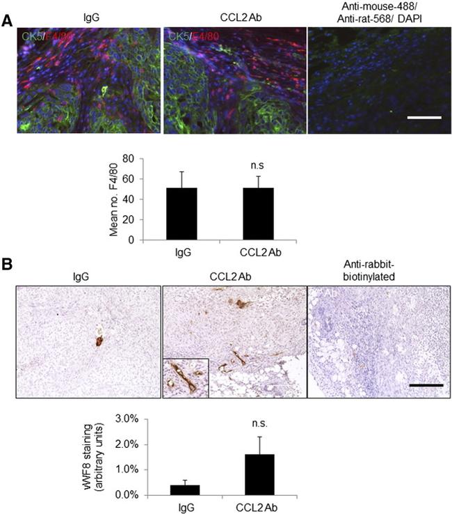 Cytokeratin 5 Antibody in Immunohistochemistry (IHC)