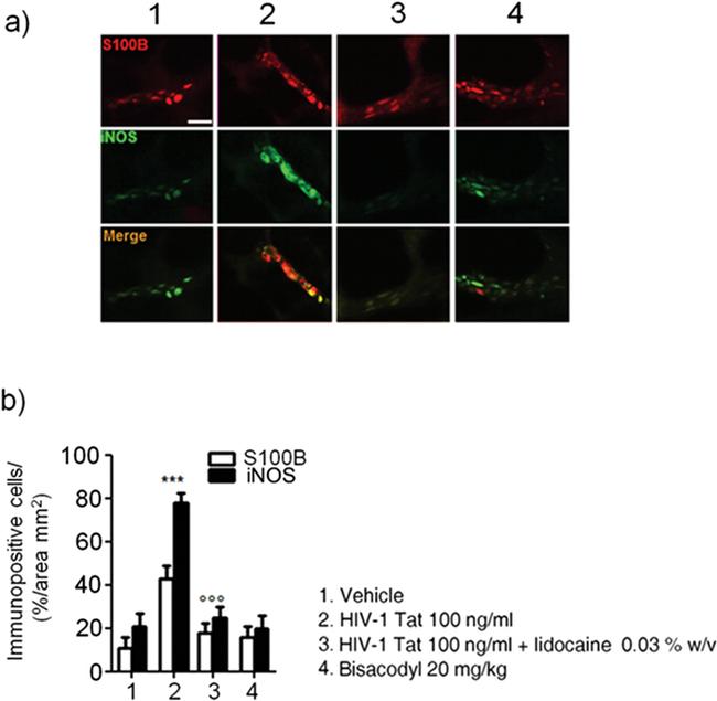 S100B Antibody in Immunohistochemistry (IHC)