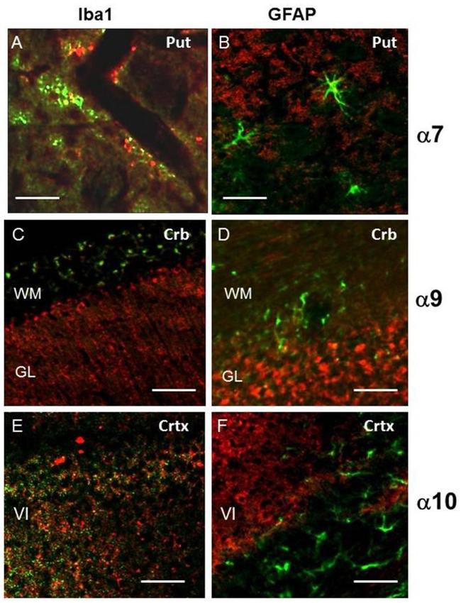 IBA1 Antibody in Immunohistochemistry (IHC)