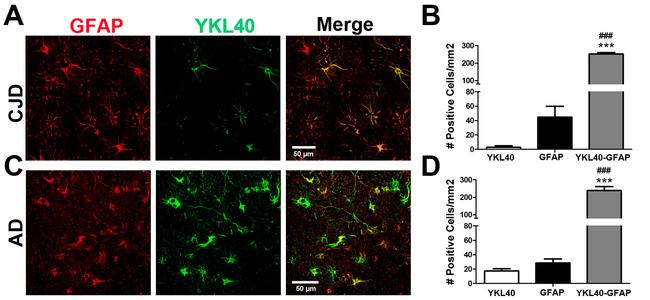 CHI3L1 Antibody in Immunohistochemistry (IHC)