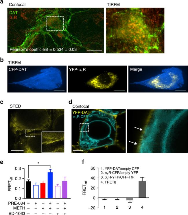 Sigma-1 Receptor Antibody in Immunocytochemistry (ICC/IF)