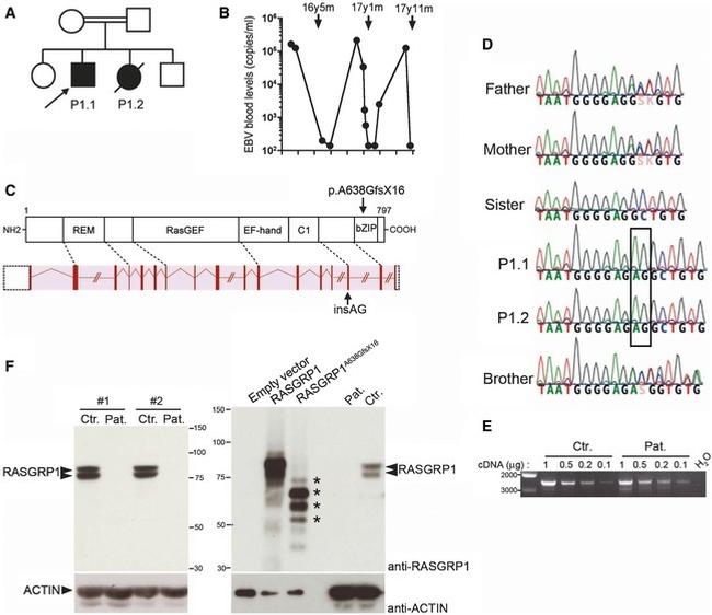 RASGRP1 Antibody in Western Blot (WB)