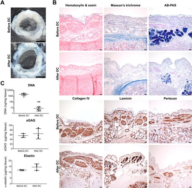 Perlecan Antibody in Immunohistochemistry (IHC)