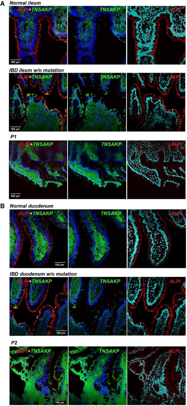 Intestinal Alkaline Phosphatase Antibody in Immunohistochemistry (IHC)