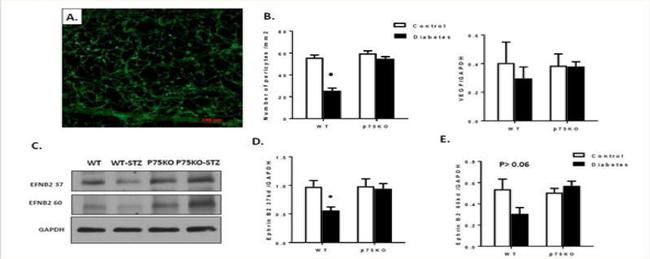 Ephrin B2 Antibody in Western Blot (WB)