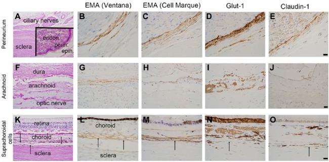 Claudin 1 Antibody in Immunohistochemistry (IHC)