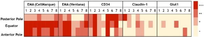 Claudin 1 Antibody in Immunohistochemistry (IHC)