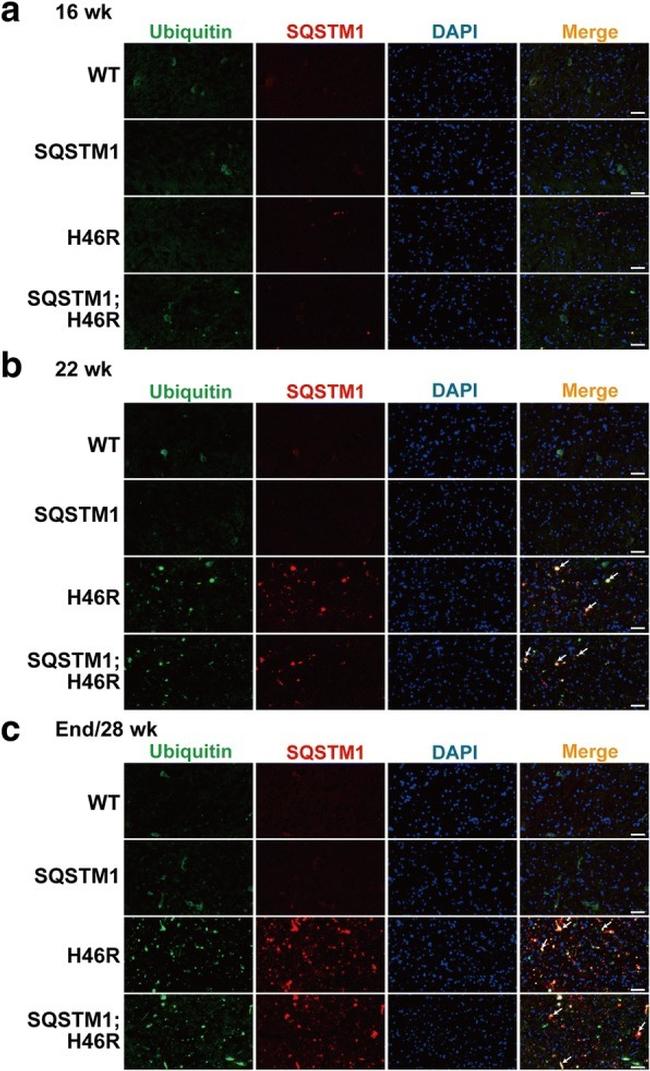 SQSTM1 Antibody in Immunohistochemistry (IHC)