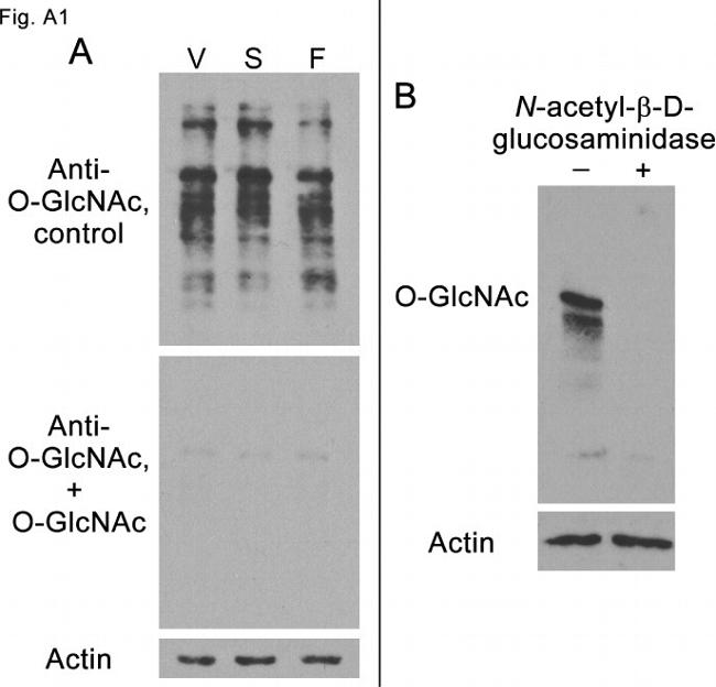 O-linked N-acetylglucosamine (O-GlcNAc) Antibody in Western Blot (WB)