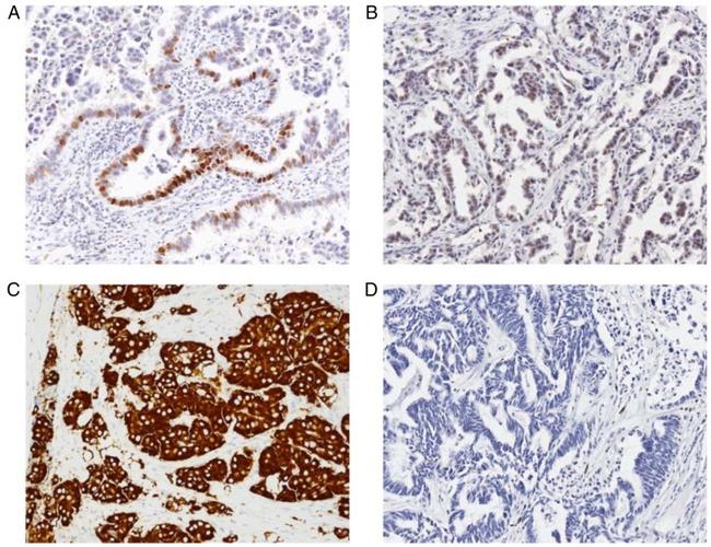 Estrogen Receptor alpha Antibody in Immunohistochemistry (IHC)